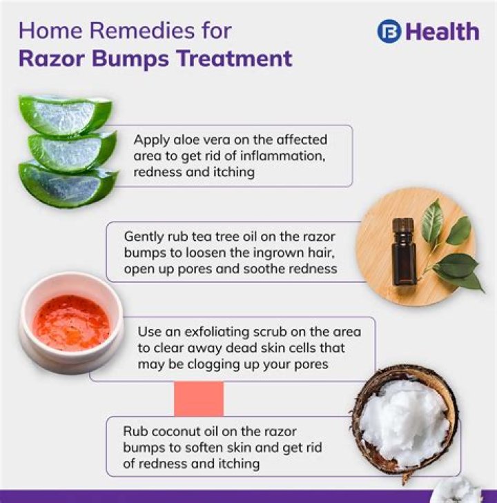 6 remedies for even your worst razor bumps