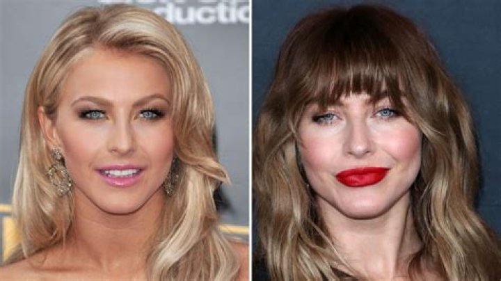 Julianne Hough Plastic Surgery Before and After