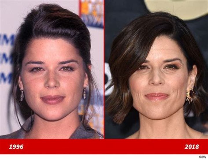 Neve Campbell Plastic Surgery Before and After